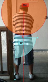 Podologo especialista en deporte Podologia deportiva asturias