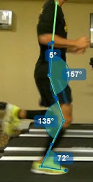 Podologo para deportistas podologo-deporte-asturias