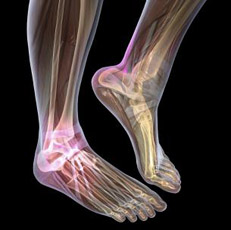 Quiropodologia en Podologo de Villaviciosa asturias Quiropodología en Villaviciosa Asturias