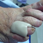 Servicios de ortopodología Ortopodología en Clinica del Pie en Asturias